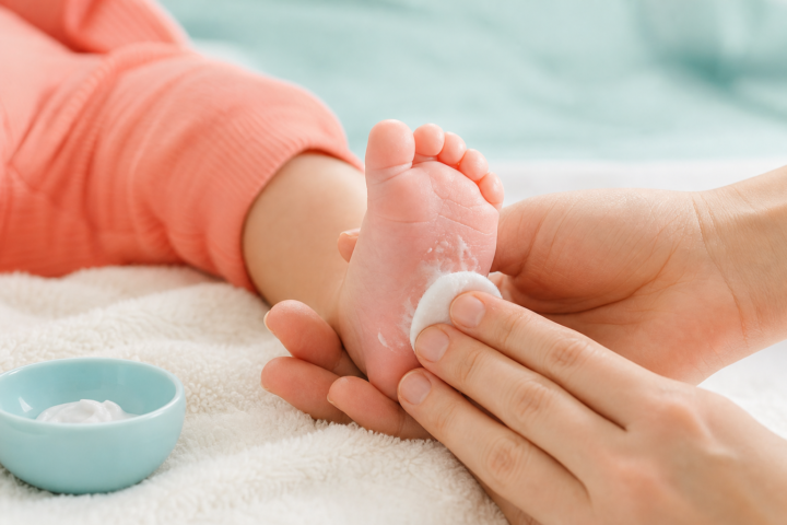 Caregiver applying moisturizer to a baby's peeling toes over a soft towel
